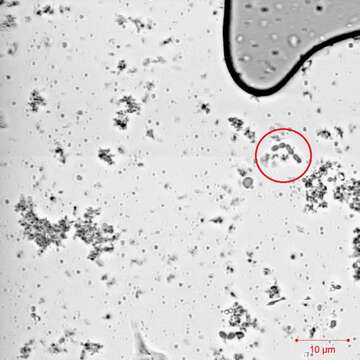 Image of Streptococcus thermophilus