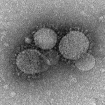 Image of Middle East respiratory syndrome-related coronavirus