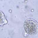 Image of Vorticella campanula