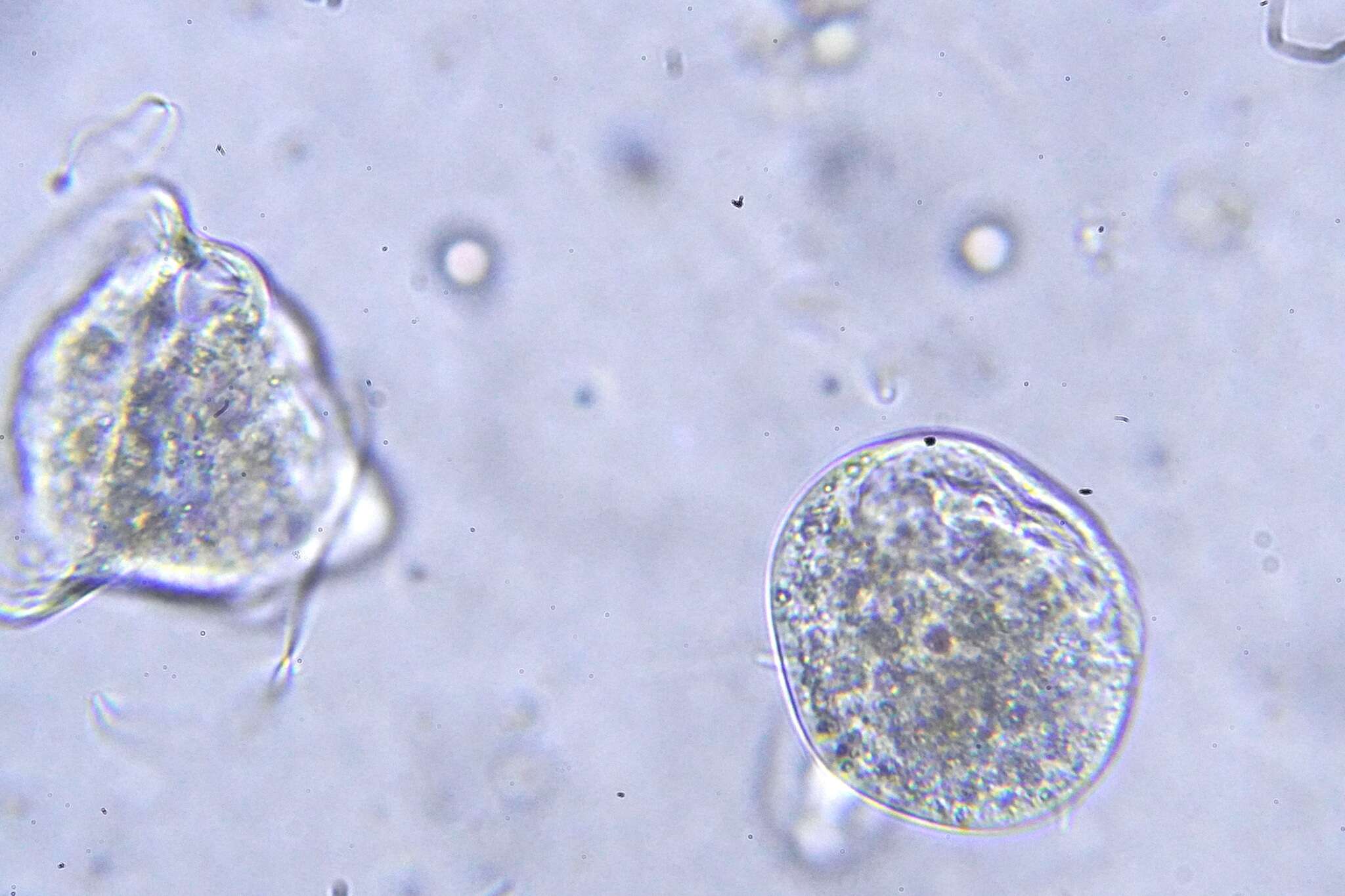 Image of Vorticella campanula