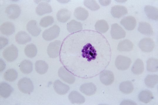 Image of Plasmodium malariae