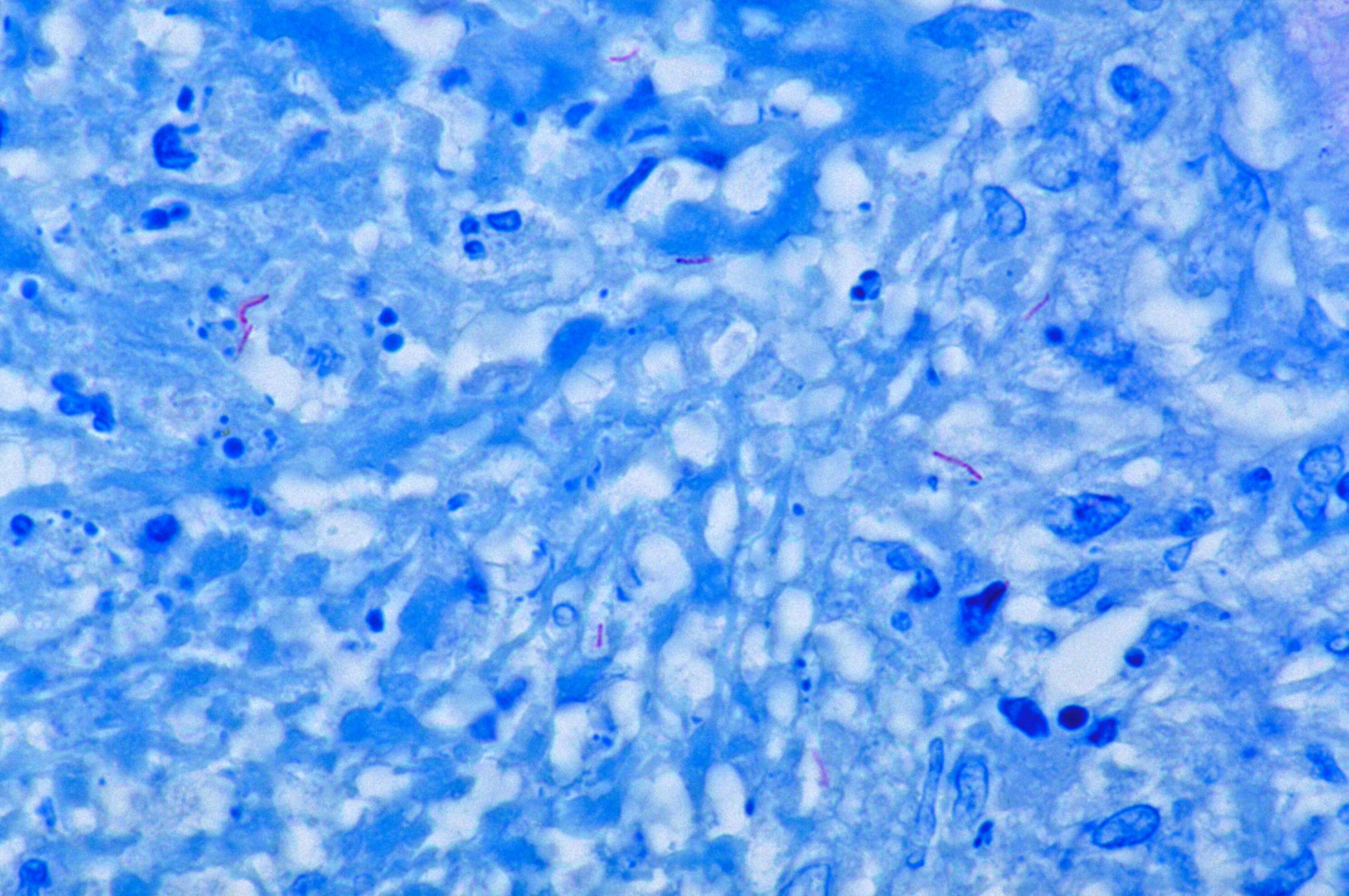 Image of 'Mycobacterium tuberculosis complex'