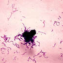 Imagem de Streptococcus mutans