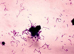 Image de Streptococcus mutans
