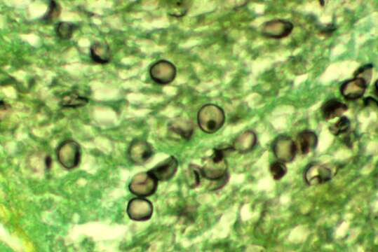 Слика од Pneumocystomycetes