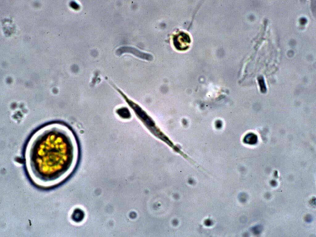 Image of Selenastraceae