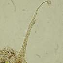 Image de Echinostelium apitectum K. D. Whitney 1980