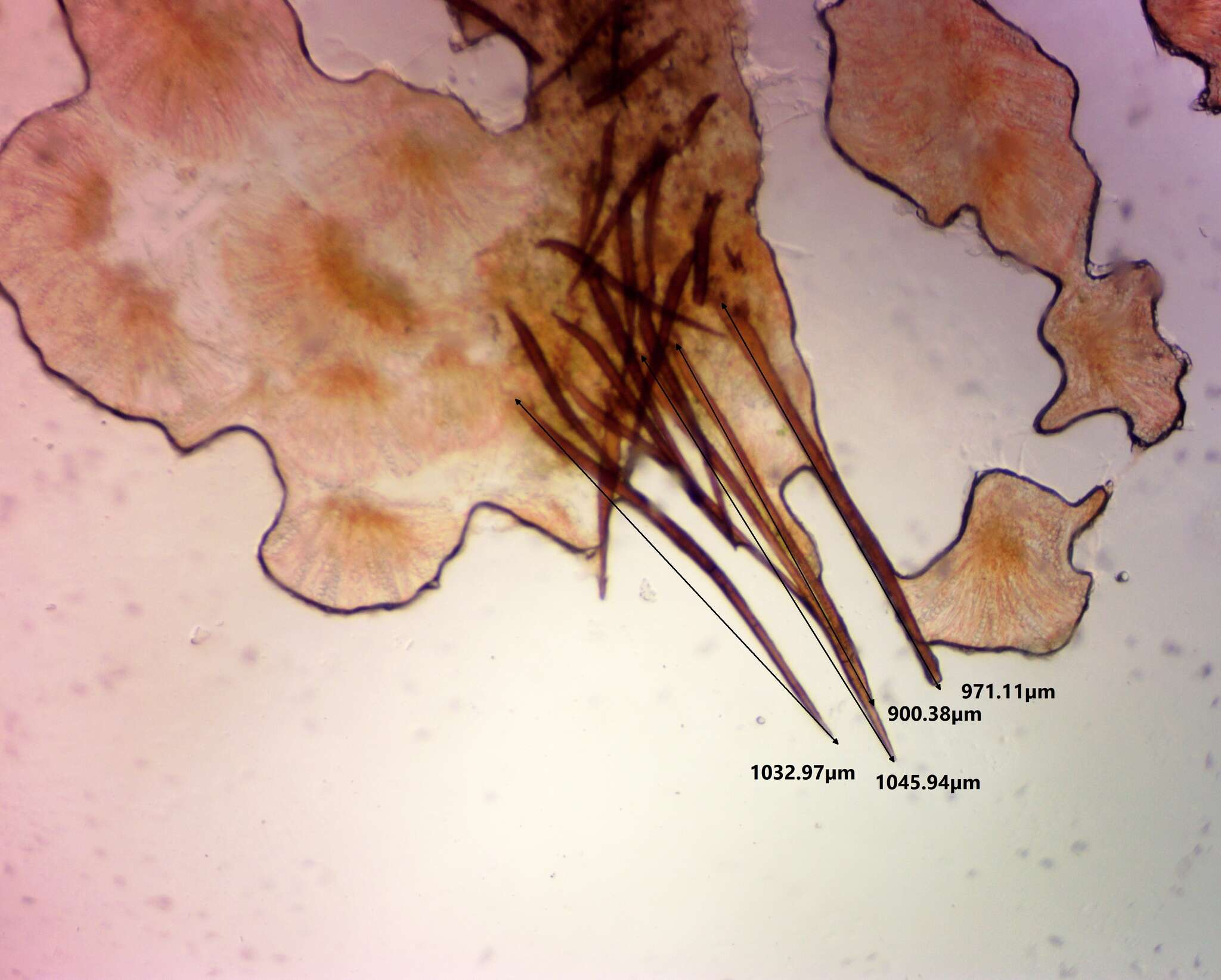 Image of Scutellinia subhirtella Svrček 1971