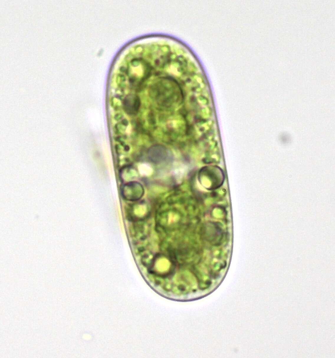 صورة Cylindrocystis brebissonii
