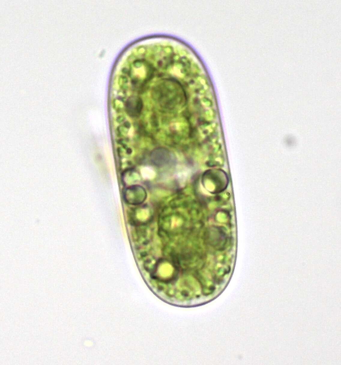 Image of Cylindrocystis brebissonii