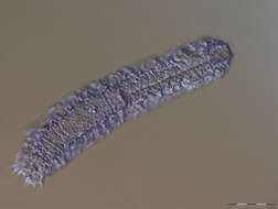 Image of gastrotrichs