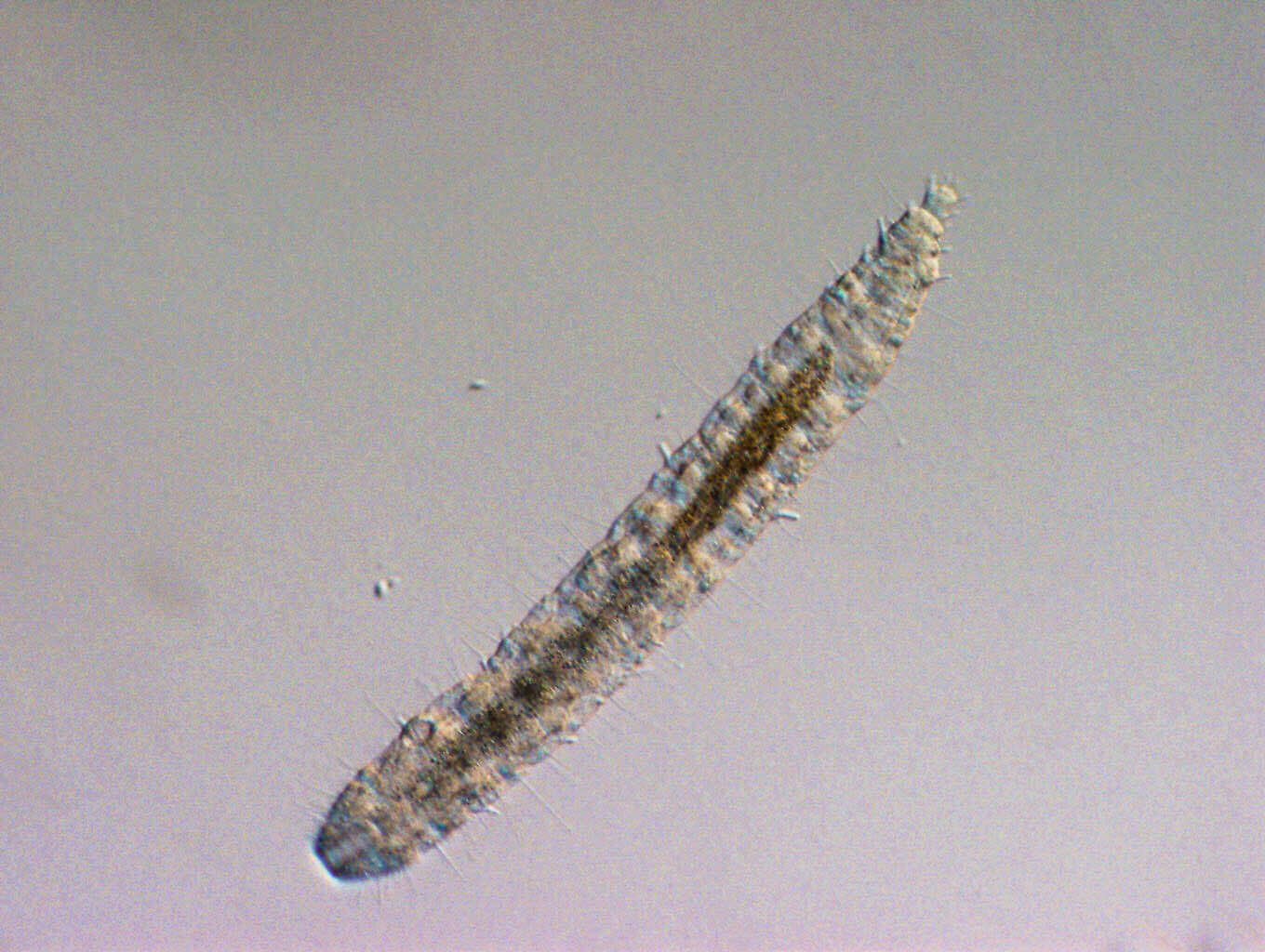 Image of gastrotrichs