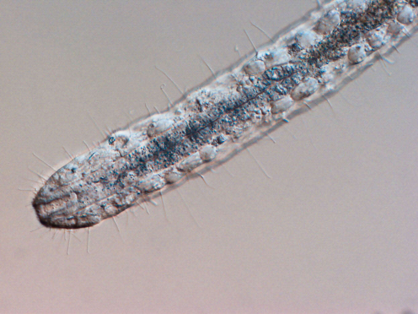 Image of gastrotrichs