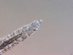 Image of gastrotrichs