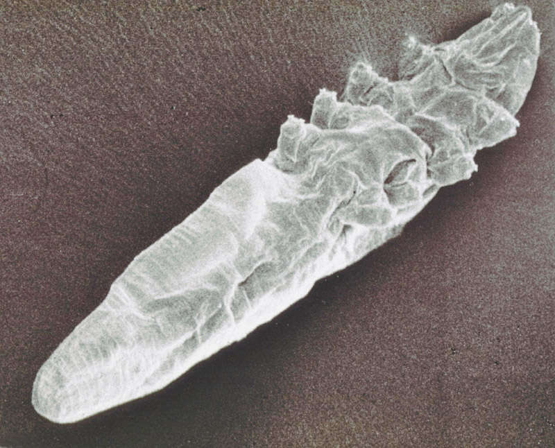 Image of Demodex brevis Akbulatova 1963