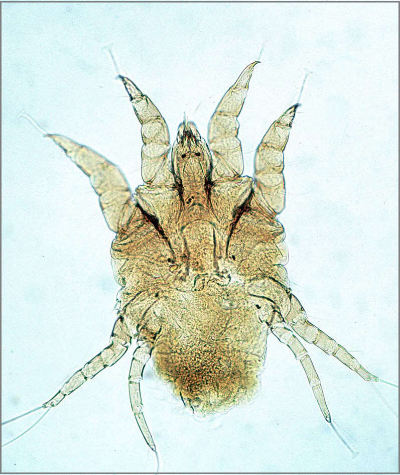 Image of Psoroptes