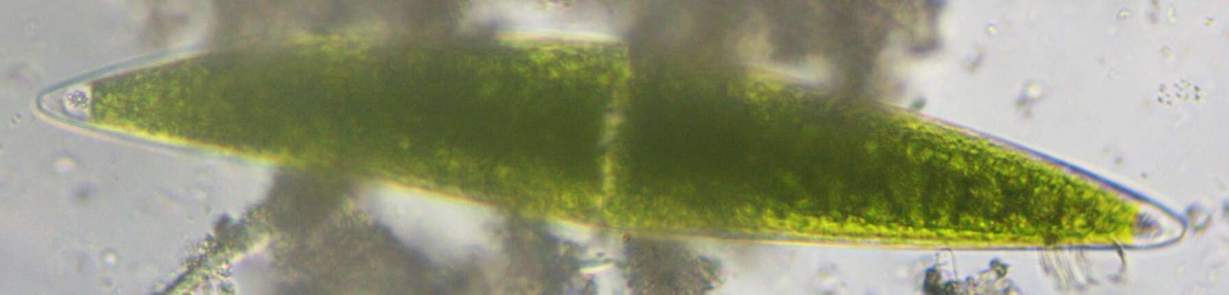 Image of Closterium acerosum f. lanceolatum