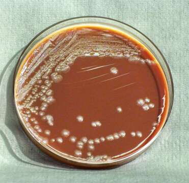 Image of 'Yersinia pseudotuberculosis complex'