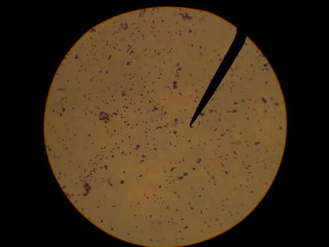 Image of Staphylococcus epidermidis