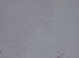 Image of Enterobacteriaceae