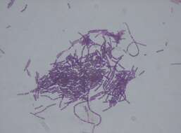 Image of Bacillus thuringiensis