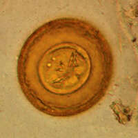 Image of Hymenolepis diminuta