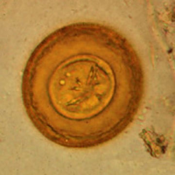 Image of <i>Hymenolepis diminuta</i> (Rudolphi 1819) Rudolphi 1819