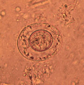 Image of Hymenolepis nana