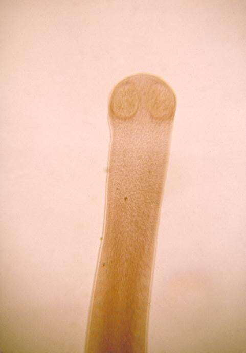 Image of Hymenolepis
