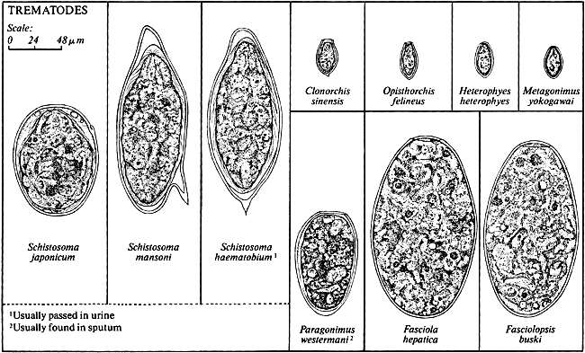 Image of Schistosoma haematobium