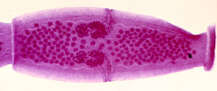 Image of Dipylidium caninum