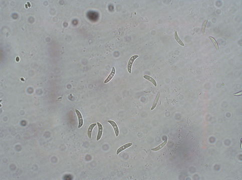 Image of Colletotrichum