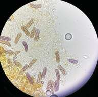 صورة Saccobolus citrinus Boud. & Torrend 1911