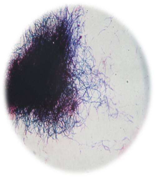 Image of Actinomycetales