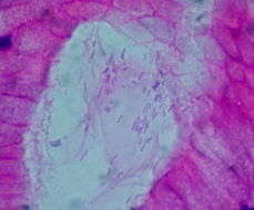 Image of Helicobacter