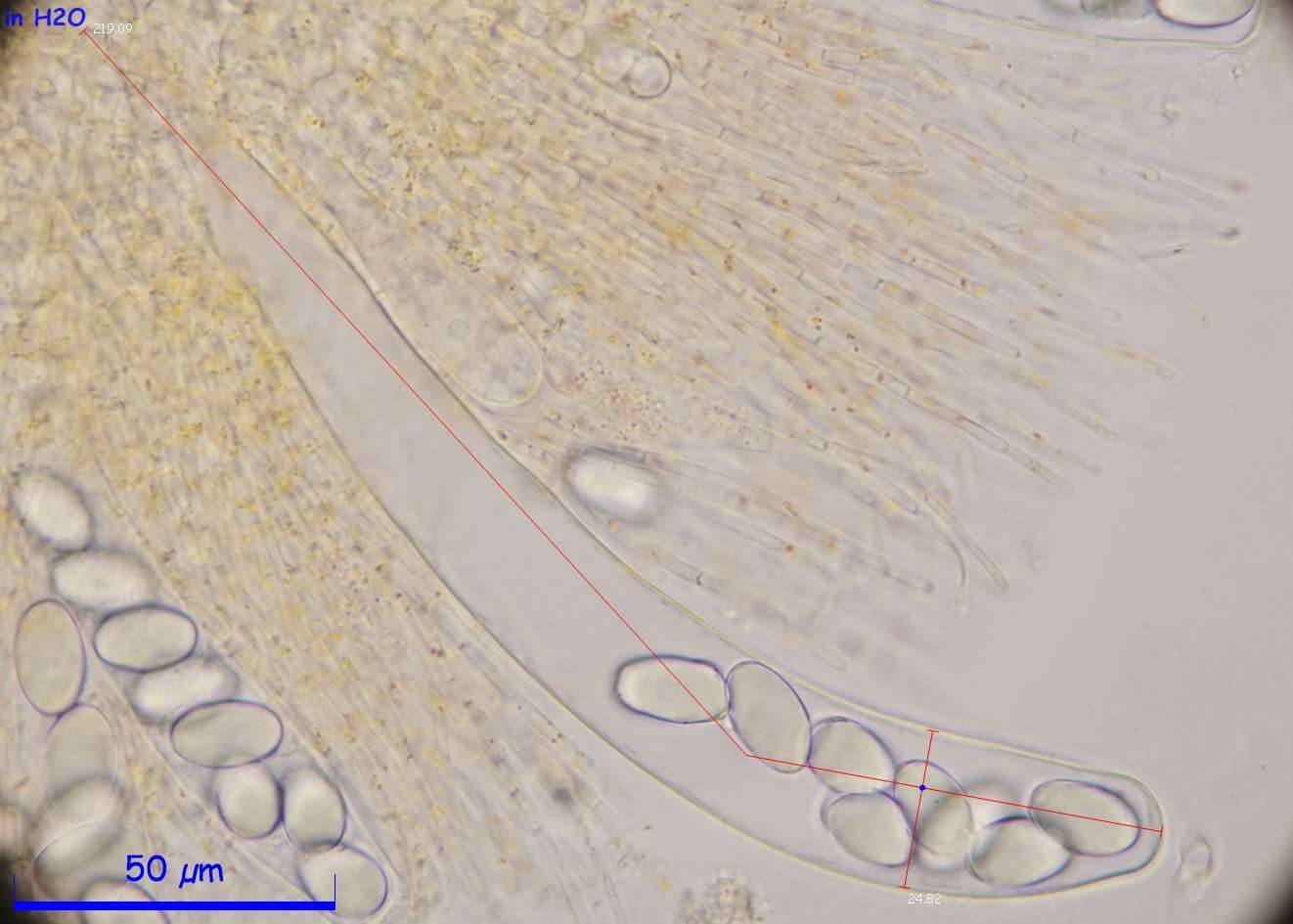 Image de Lasiobolus intermedius J. L. Bezerra & Kimbr. 1975