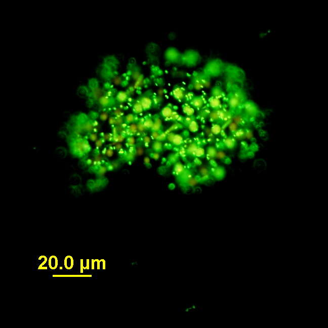 Plancia ëd Microcystis Lemmermann 1907