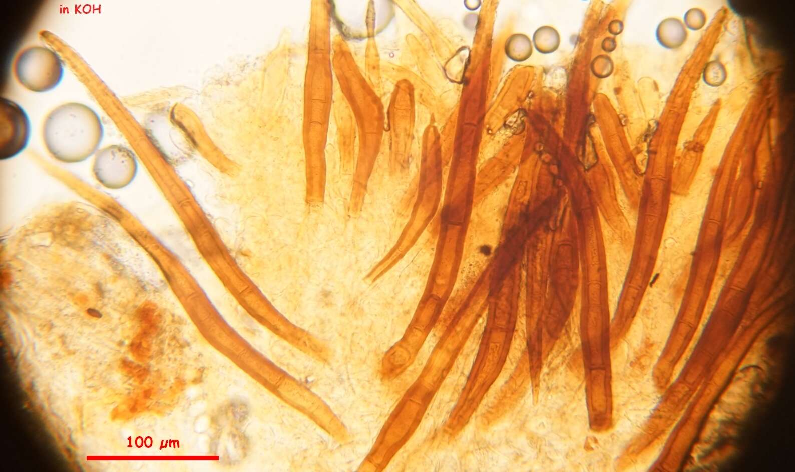 Image of Scutellinia nigrohirtula (Svrček) Le Gal 1964