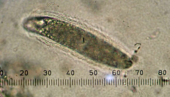 Image of Pertusaria thiospoda C. Knight