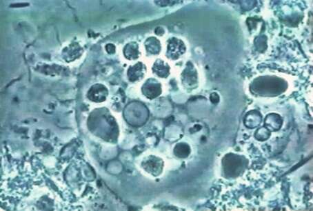 Image of Entamoeba gingivalis