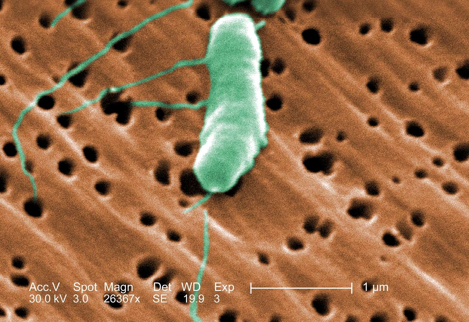 Image of Vibrio vulnificus