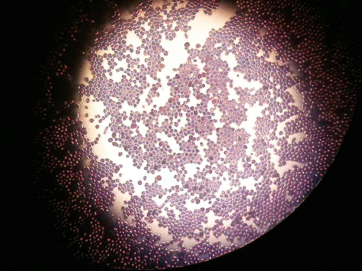 Imagem de Saccharomyces cerevisiae