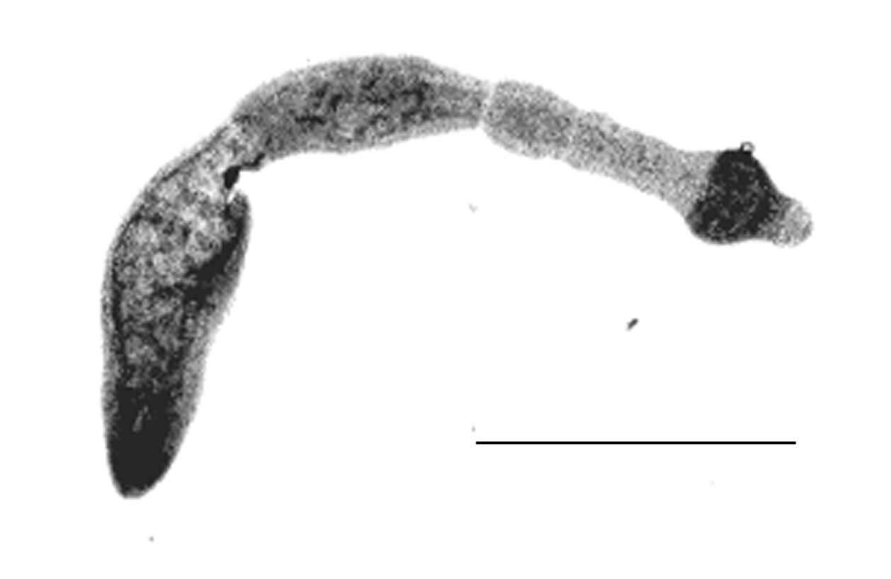 Image of Echinococcus multilocularis