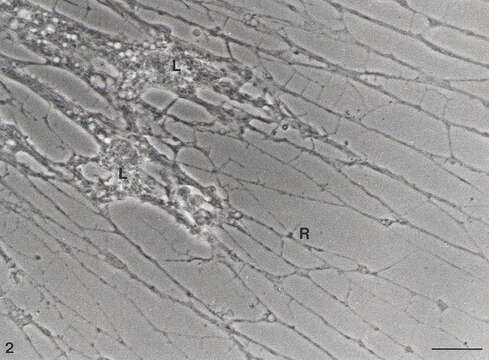 صورة Reticulomyxidae