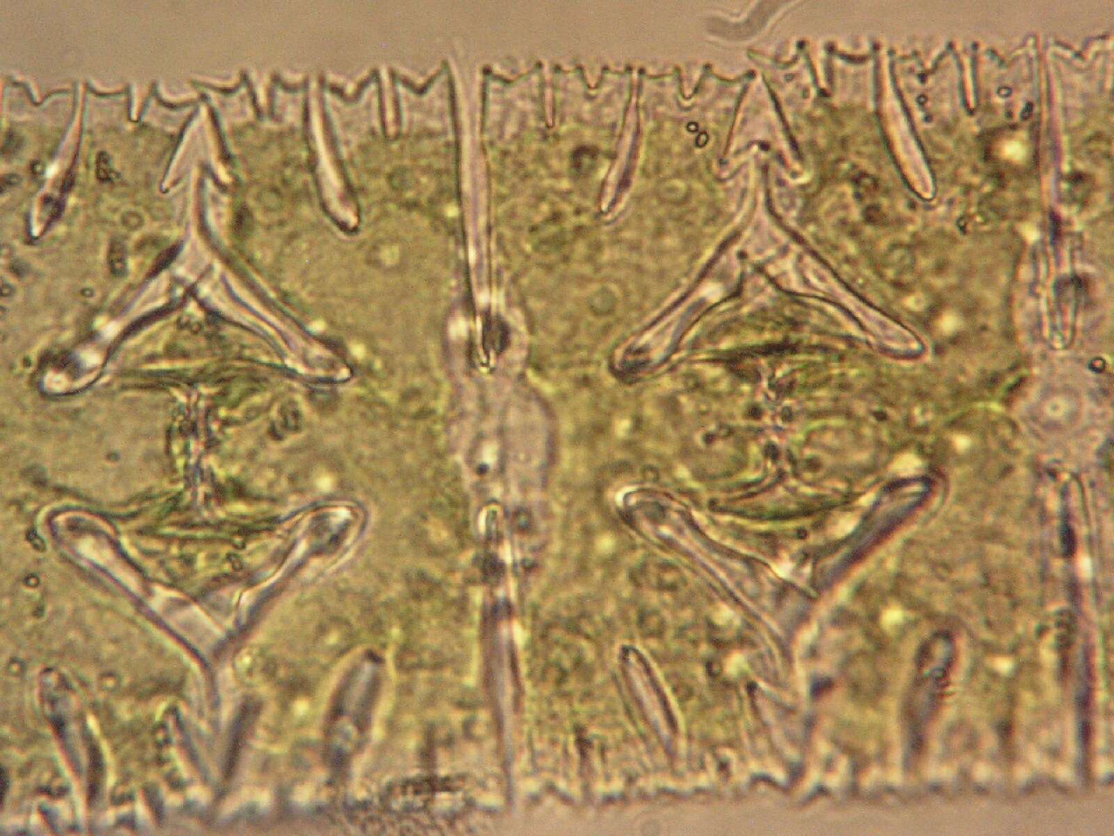 Image of Micrasterias foliacea