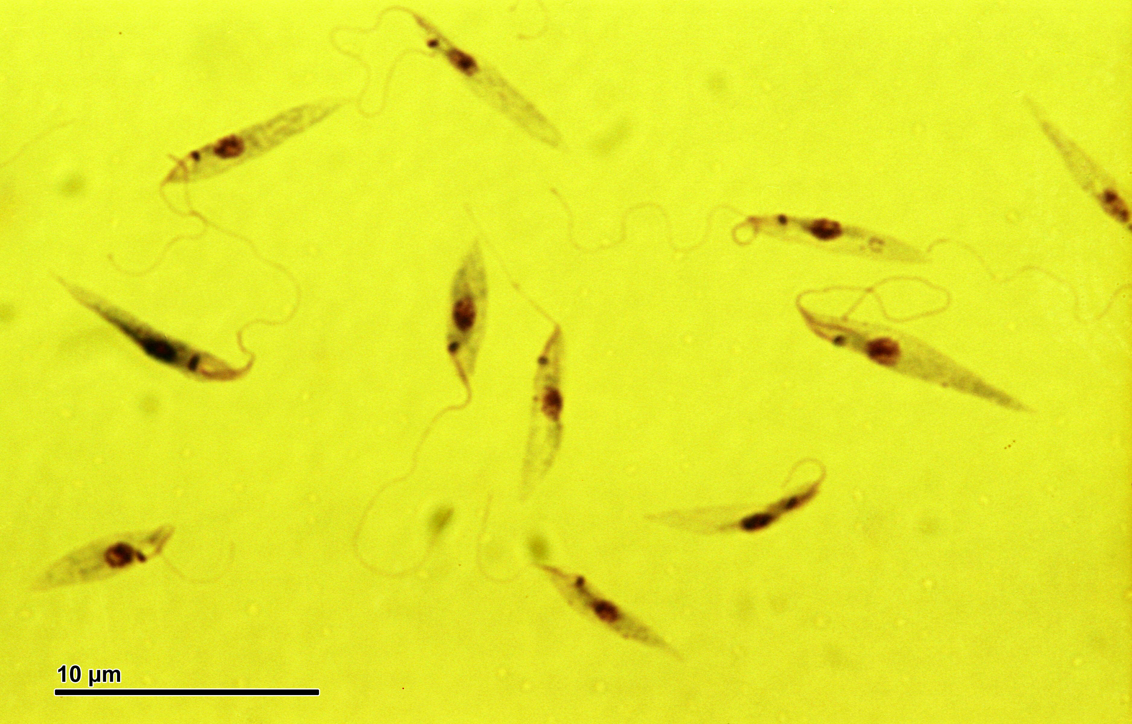 Image of Leishmania tropica