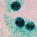 Image of Entamoeba histolytica