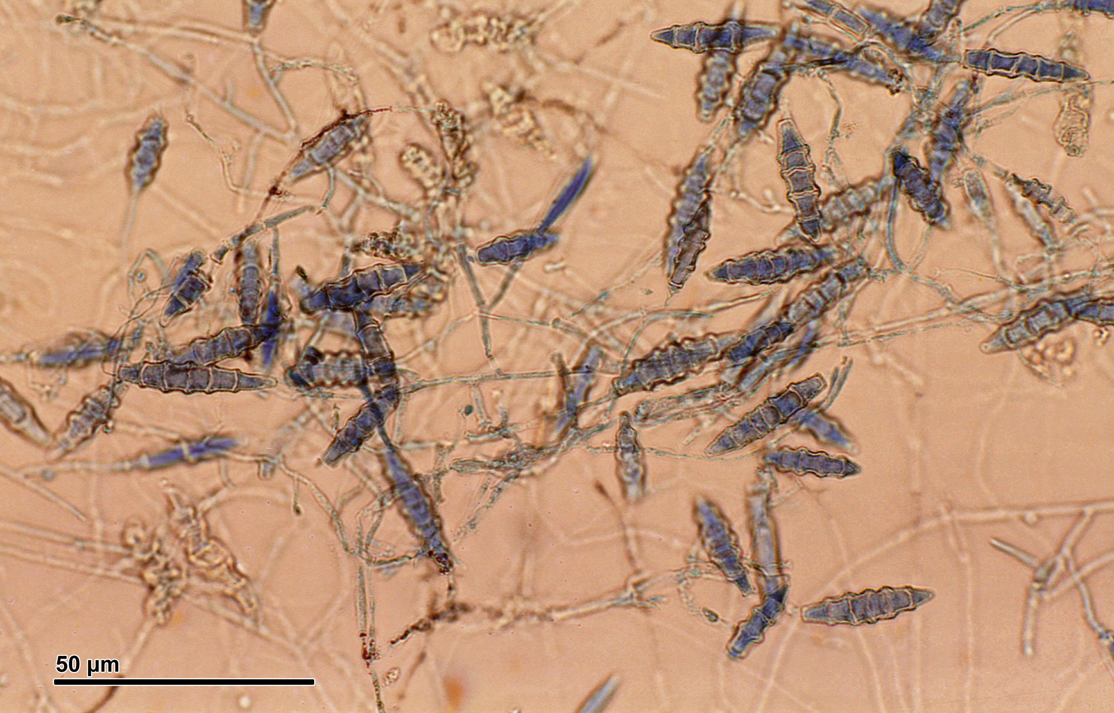 Sivun Microsporum gypseum (E. Bodin) Guiart & Grigoraki 1928 kuva