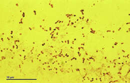 Imagem de Streptococcus pneumoniae