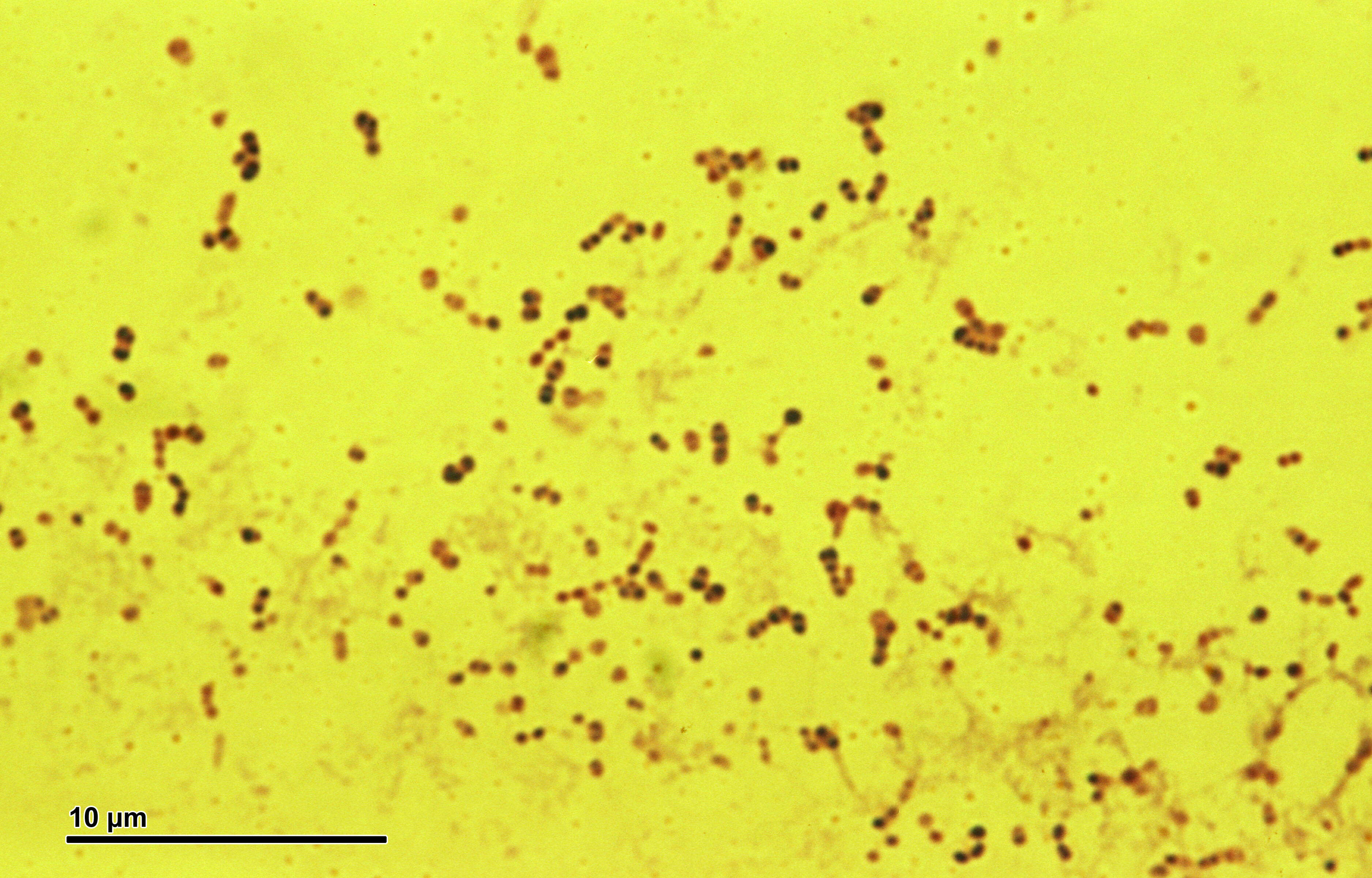 Image de Streptococcus pneumoniae